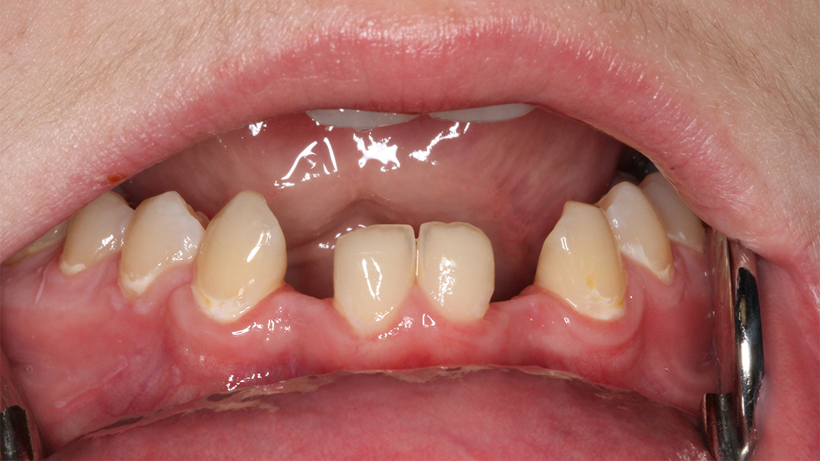 Sharp Dentistry | Ceramic Crowns, Implant Dentistry and CBCT