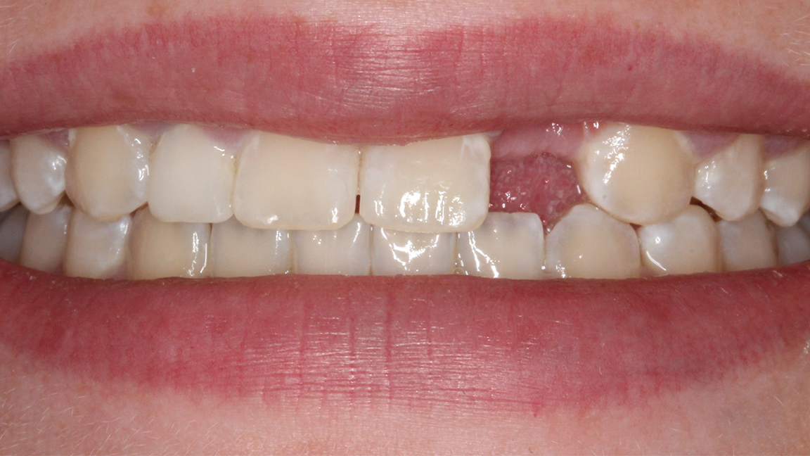 Sharp Dentistry | CBCT, Dental Lab and Fluoride Treatment