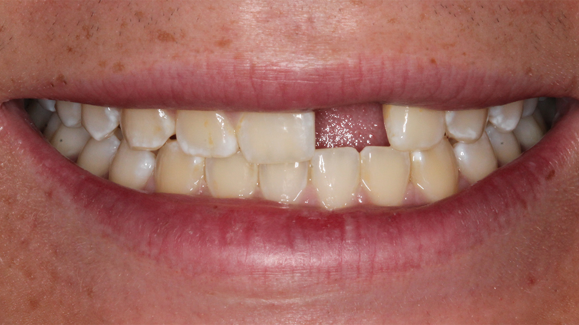 Sharp Dentistry | Inlays & Onlays, Dental Cleanings and Preventative Program