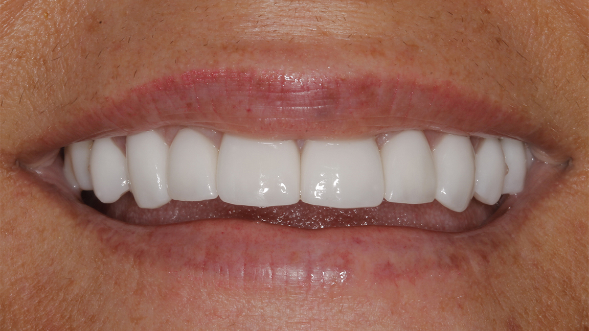 Sharp Dentistry | Sleep Apnea, Dentures and Extractions