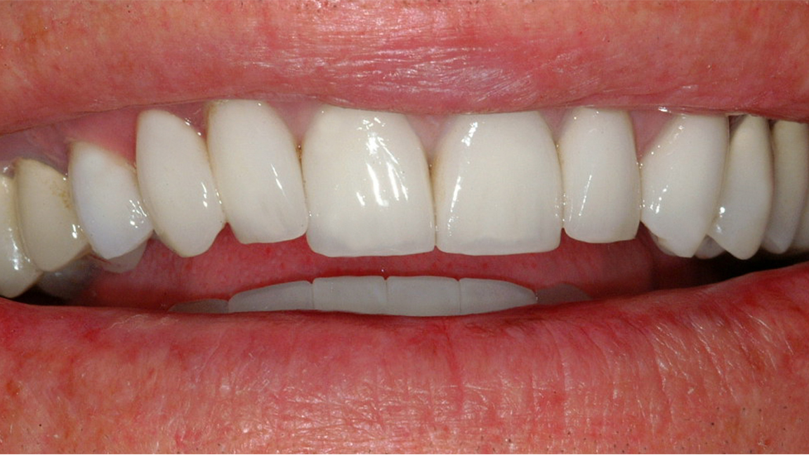 Sharp Dentistry | Emergency Treatment, Digital Radiography and Crowns