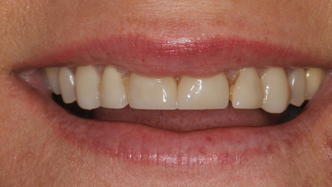 Sharp Dentistry | Emergency Treatment, Periodontal Treatment and Implant Restorations