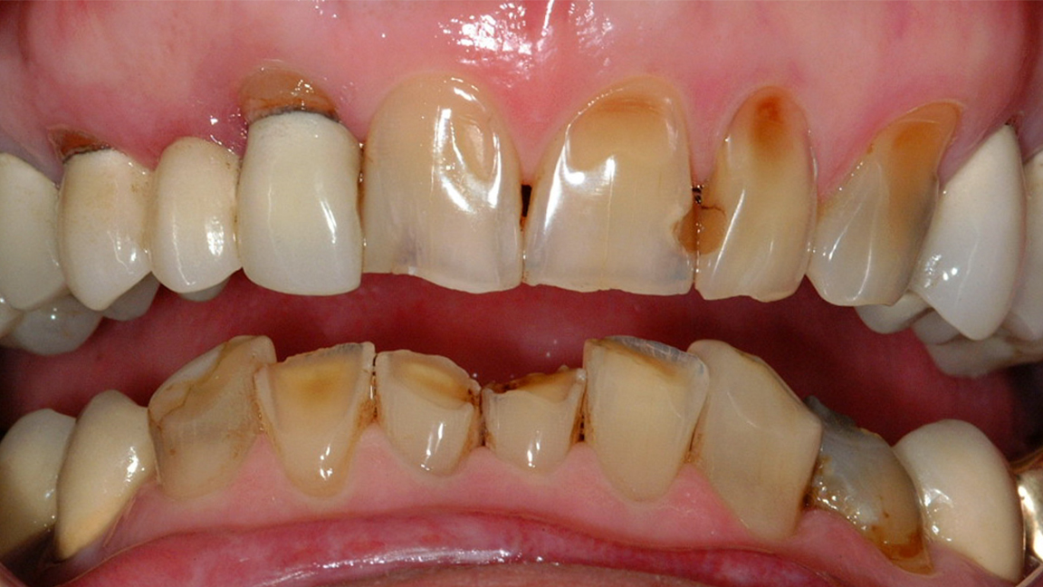 Sharp Dentistry | Dentures, Cosmetic Dentistry and Periodontal Treatment