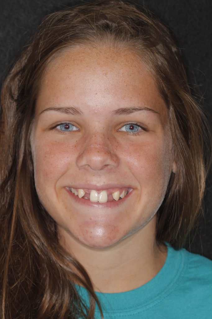 Sharp Dentistry | Veneers, Teeth Whitening and Sleep Apnea