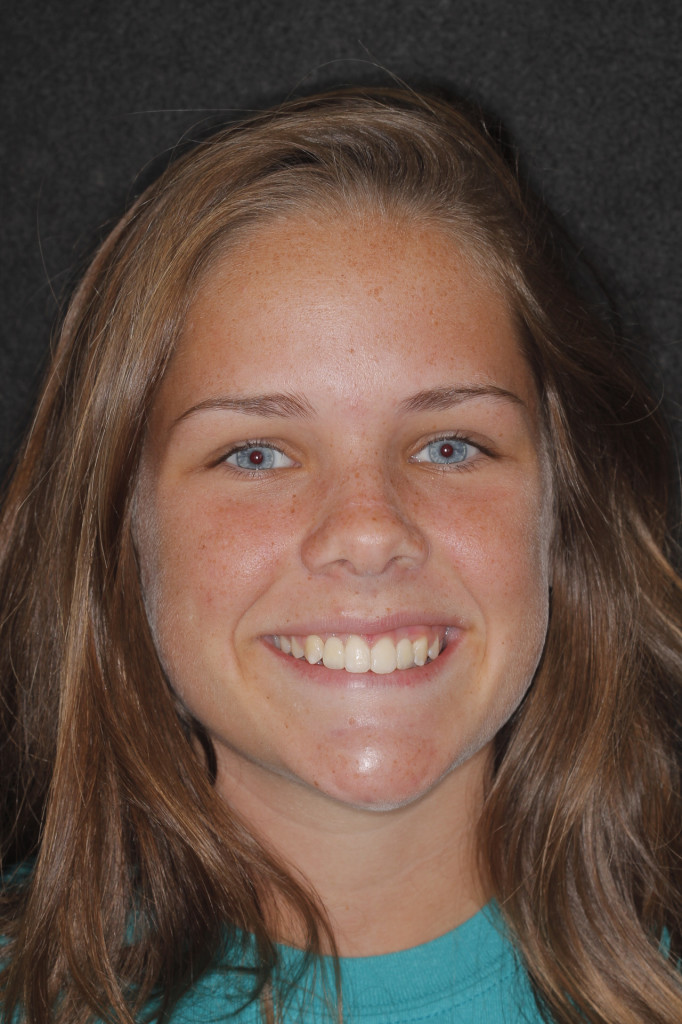 Sharp Dentistry | Intraoral Camera, Dental Lab and Dental Fillings