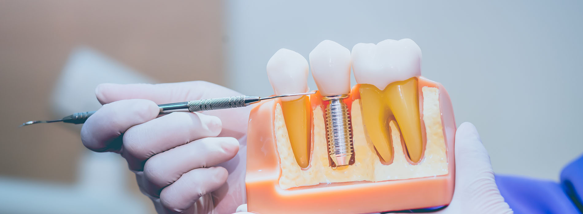 Sharp Dentistry | Veneers, Sedation Dentistry and Ceramic Crowns