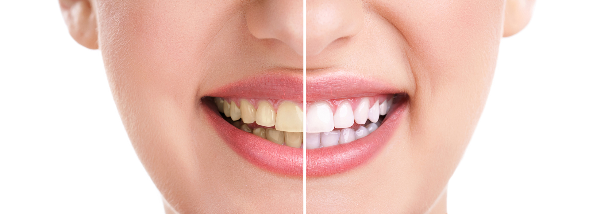 Sharp Dentistry | Crowns, Preventative Program and Teeth Whitening
